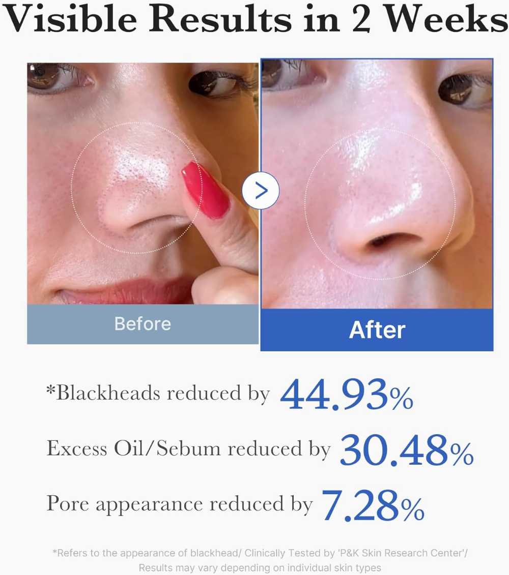 Medicube Dual-Textured Facial Toner Pads | ميديكيوب – فوط تونر للوجه مزدوجة الملمس